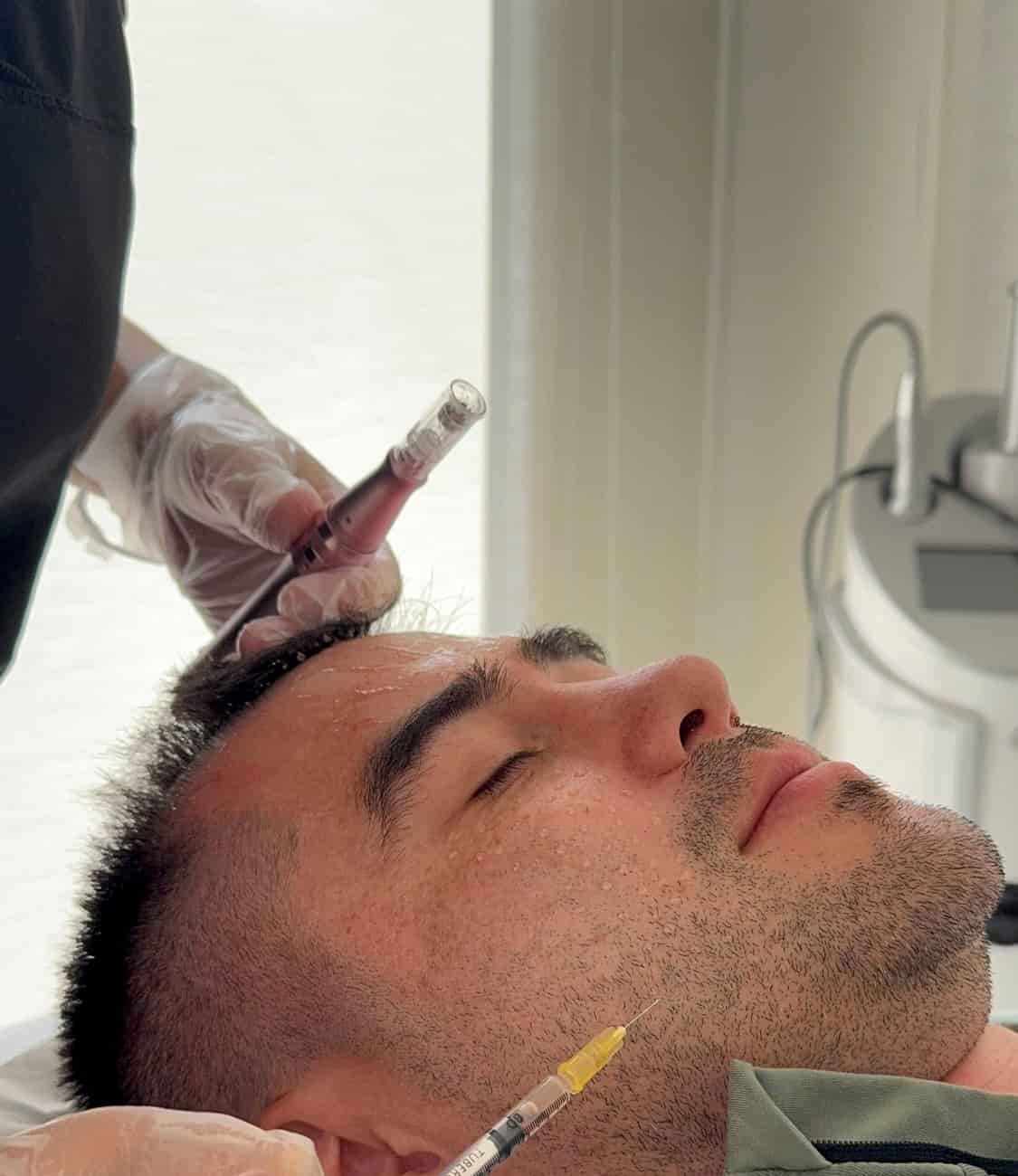 Tratamiento de endolaser y rejuvenecimiento facial masculino en Protocolo Lumina